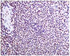 Immunohistochemistry (Formalin/PFA-fixed paraffin-embedded sections) - Anti-ILF2/NF45 antibody [EPR10695(B)] - BSA and Azide free (AB249101)