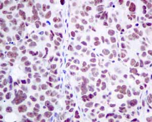 Immunohistochemistry (Formalin/PFA-fixed paraffin-embedded sections) - Anti-ILF2/NF45 antibody [EPR10695(B)] - BSA and Azide free (AB249101)