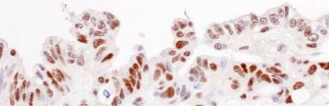 Immunohistochemistry (Formalin/PFA-fixed paraffin-embedded sections) - Anti-ILF3 antibody (AB225626)