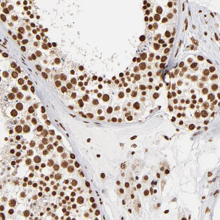 Immunohistochemistry (Formalin/PFA-fixed paraffin-embedded sections) - Anti-ILF3 Antibody (AB327172)