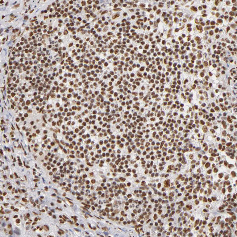 Immunohistochemistry (Formalin/PFA-fixed paraffin-embedded sections) - Anti-ILF3 Antibody (AB327172)