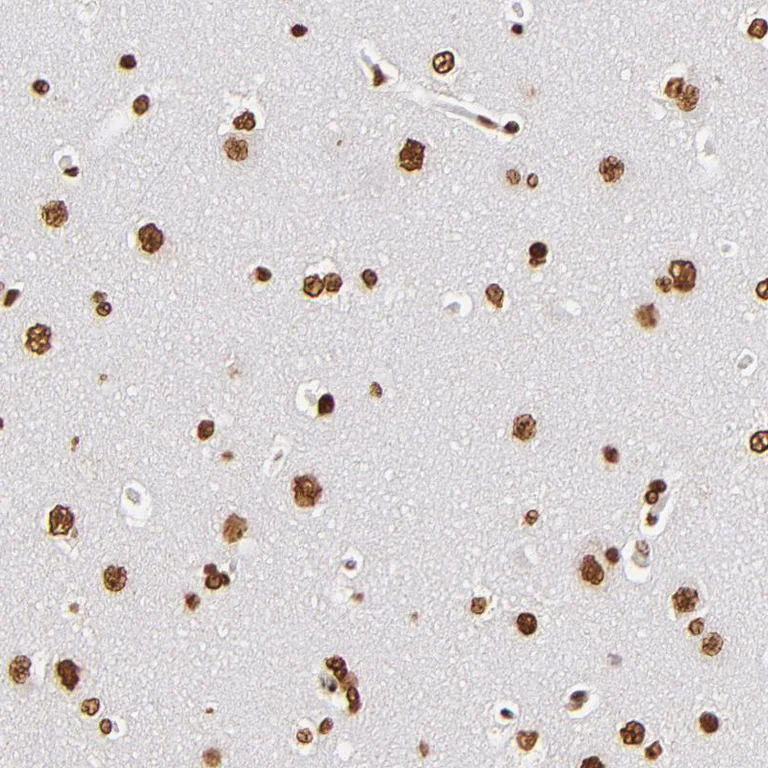Immunohistochemistry (Formalin/PFA-fixed paraffin-embedded sections) - Anti-ILF3 Antibody (AB327172)