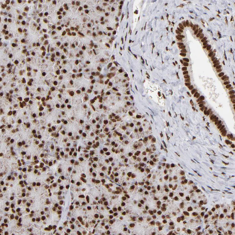 Immunohistochemistry (Formalin/PFA-fixed paraffin-embedded sections) - Anti-ILF3 Antibody (AB327172)