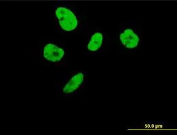 Immunocytochemistry - Anti-ILF3 antibody (AB89100)