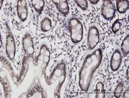 Immunohistochemistry (Formalin/PFA-fixed paraffin-embedded sections) - Anti-ILF3 antibody (AB89100)