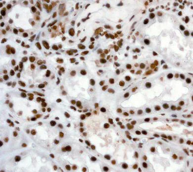 Immunohistochemistry (Formalin/PFA-fixed paraffin-embedded sections) - Anti-ILF3 antibody [EPR3626] (AB92355)