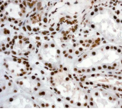 Immunohistochemistry (Formalin/PFA-fixed paraffin-embedded sections) - Anti-ILF3 antibody [EPR3626] - BSA and Azide free (AB232546)