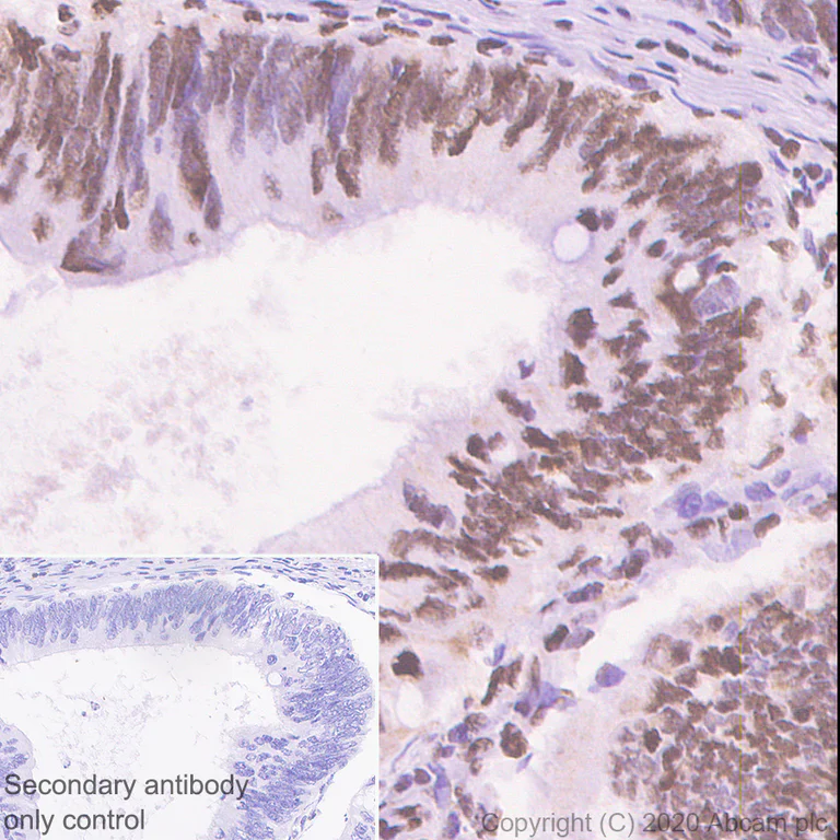 Immunohistochemistry (Formalin/PFA-fixed paraffin-embedded sections) - Anti-ILF3 antibody [EPR3627] - BSA and Azide free (AB248492)