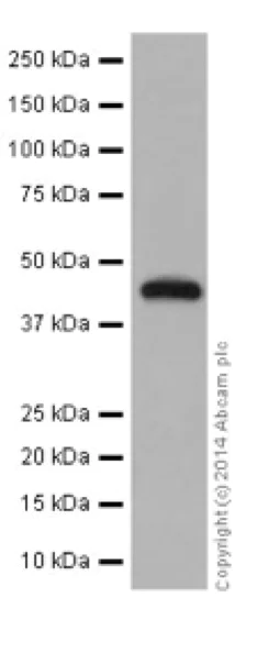 Western blot - Anti-ILKAP antibody [EPR16145] (AB196013)
