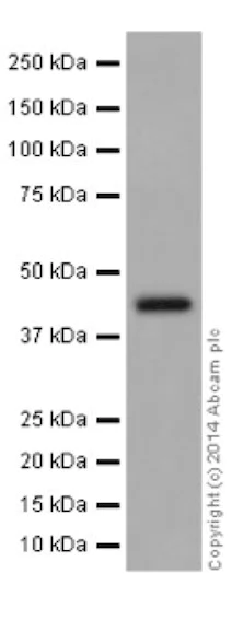 Western blot - Anti-ILKAP antibody [EPR16145] (AB196013)