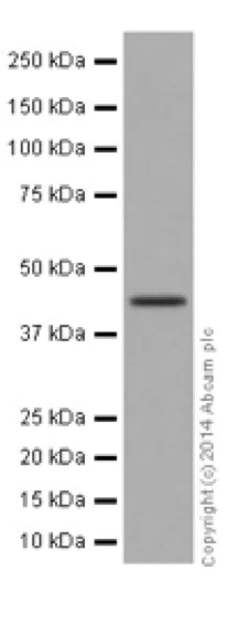 Western blot - Anti-ILKAP antibody [EPR16145] (AB196013)