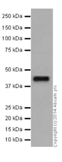 Western blot - Anti-ILKAP antibody [EPR16145] (AB196013)