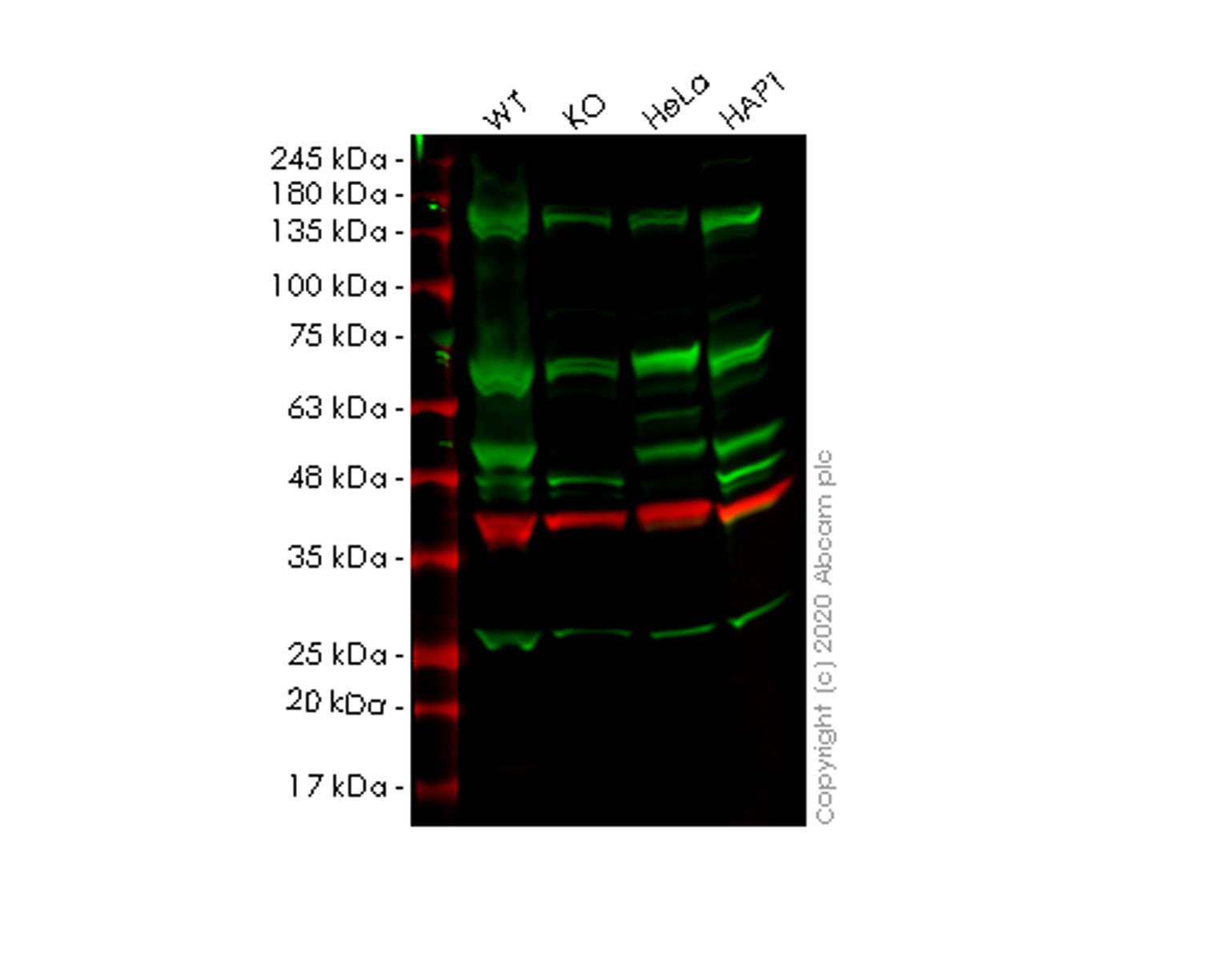 Western blot - Anti-ILKAP antibody [EPR16145] (AB196013)