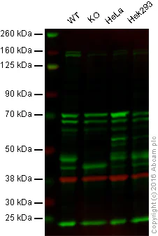 Western blot - Anti-ILKAP antibody [EPR16145] (AB196013)