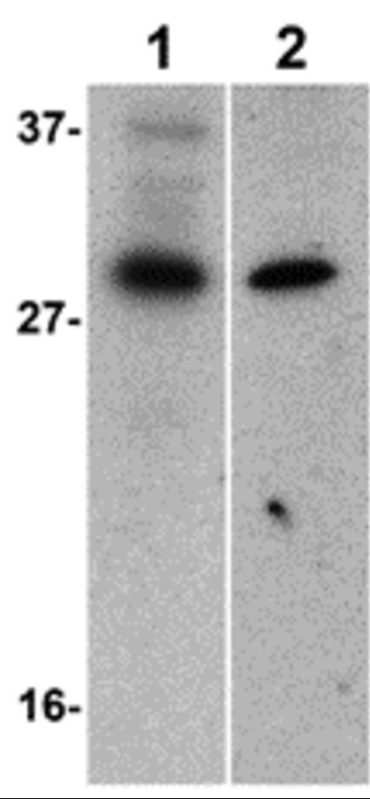 Western blot - Anti-ILP2 antibody (AB9664), expandable thumbnail