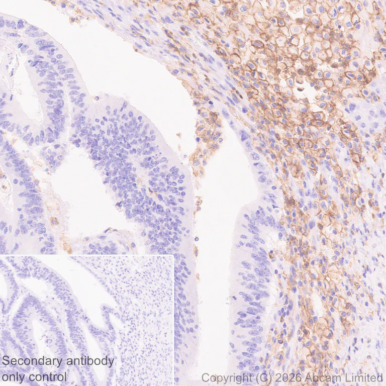 Immunohistochemistry (Formalin/PFA-fixed paraffin-embedded sections) - Anti-ILT-4 antibody [EPR29046-643] (AB327056)