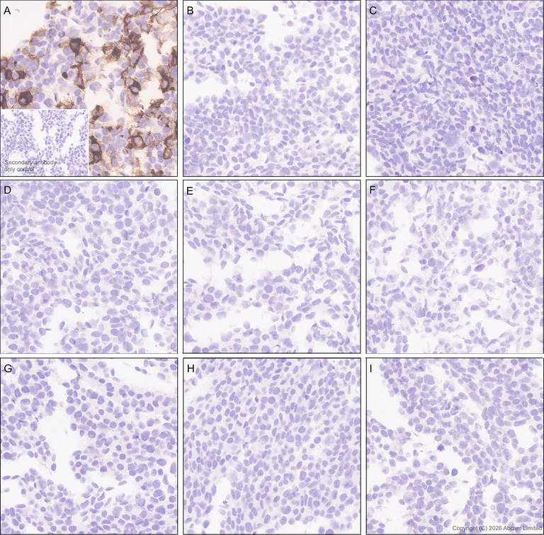 Immunohistochemistry (Formalin/PFA-fixed paraffin-embedded sections) - Anti-ILT-4 antibody [EPR29046-643] (AB327056)