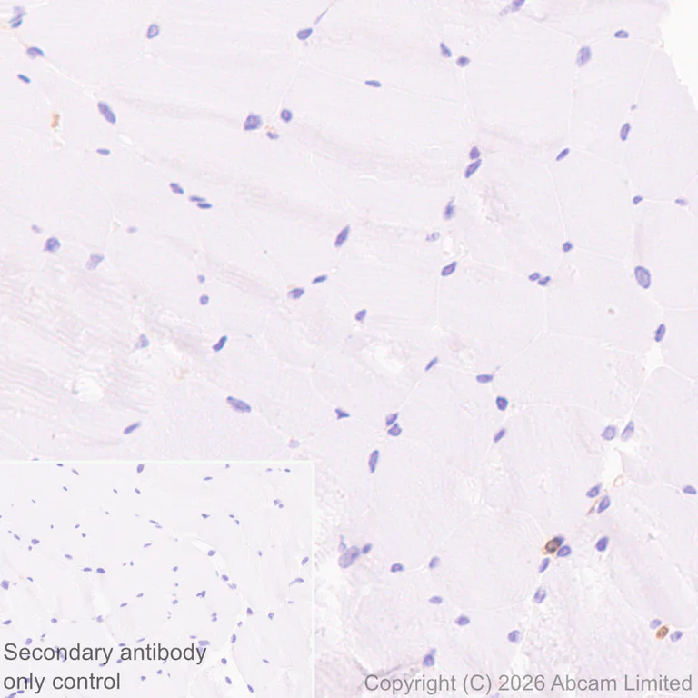 Immunohistochemistry (Formalin/PFA-fixed paraffin-embedded sections) - Anti-ILT-4 antibody [EPR29046-643] - BSA and Azide free (AB327064)