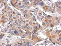 Immunohistochemistry (Formalin/PFA-fixed paraffin-embedded sections) - Anti-ILT-7 antibody (AB111703)