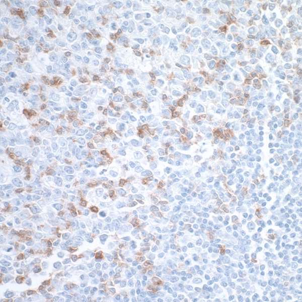 Immunohistochemistry (Formalin/PFA-fixed paraffin-embedded sections) - Immune Checkpoint Inhibitors Panel - Human IHC (AB278174)