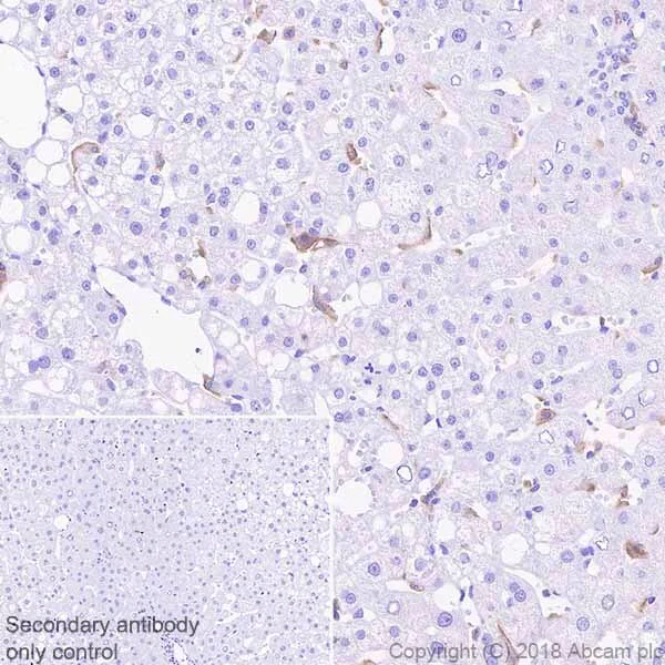 Immunohistochemistry (Formalin/PFA-fixed paraffin-embedded sections) - Immune Checkpoint Inhibitors Panel - Human IHC (AB278174)