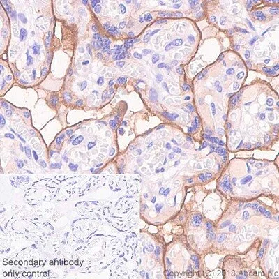 Immunohistochemistry (Formalin/PFA-fixed paraffin-embedded sections) - Immune Checkpoint Inhibitors Panel - Human IHC (AB278174)