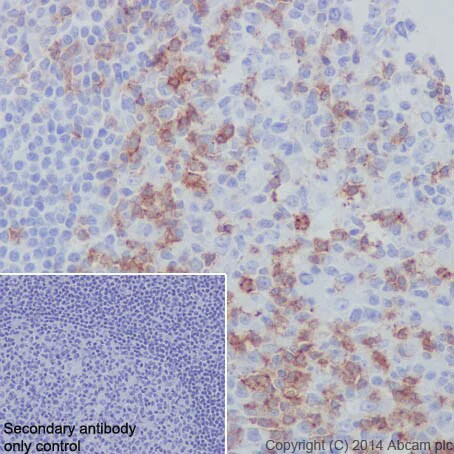 Immunohistochemistry (Formalin/PFA-fixed paraffin-embedded sections) - Immune Checkpoint Inhibitors Panel - Human IHC (AB278174)