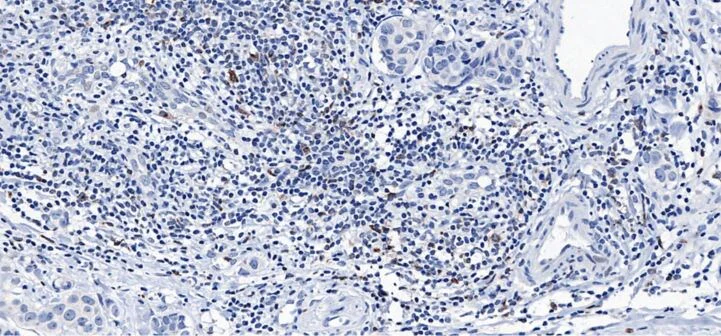 Immunohistochemistry (Formalin/PFA-fixed paraffin-embedded sections) - Immune Checkpoint Inhibitors Panel - Human IHC (AB278174)