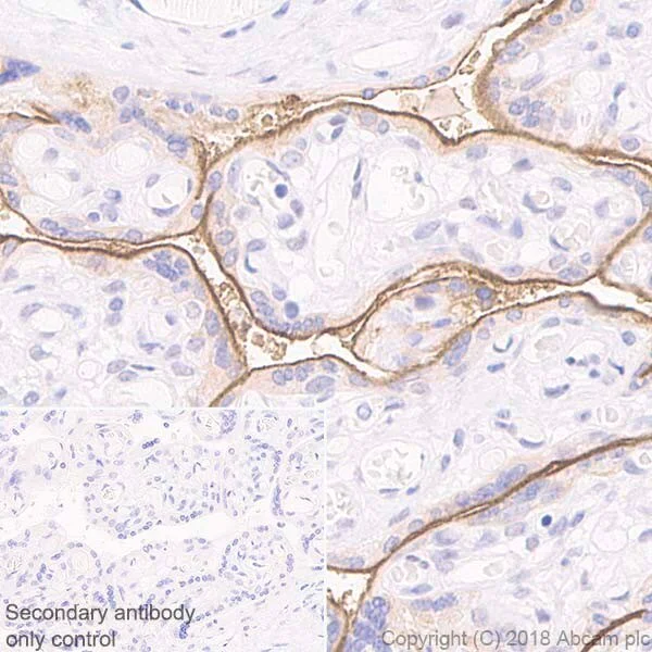 Immunohistochemistry (Formalin/PFA-fixed paraffin-embedded sections) - Immune Checkpoint Inhibitors Panel - Human IHC (AB278174)