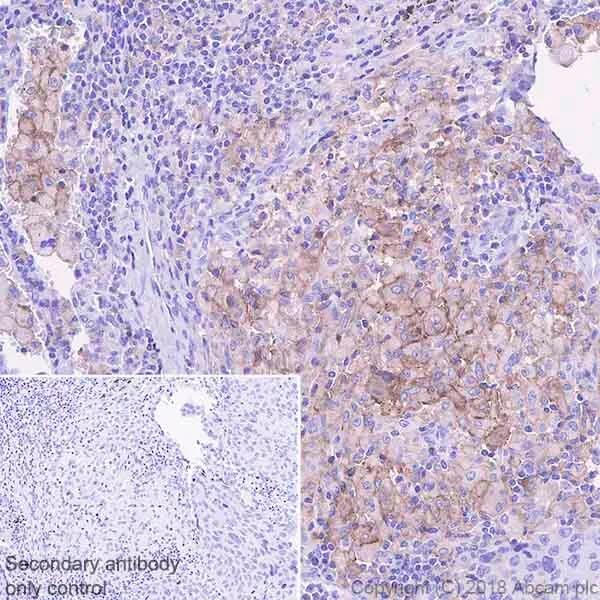 Immunohistochemistry (Formalin/PFA-fixed paraffin-embedded sections) - Immune Checkpoint Inhibitors Panel - Human IHC (AB278174)
