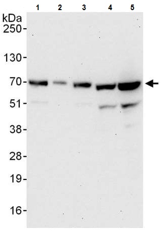 Western blot - Anti-IMP3 antibody (AB225697)