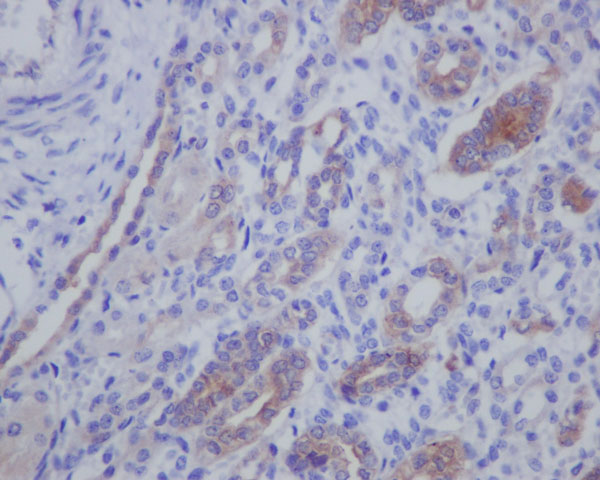 Immunohistochemistry (Formalin/PFA-fixed paraffin-embedded sections) - Anti-IMP3 antibody [EPR12021-114] (AB179807)