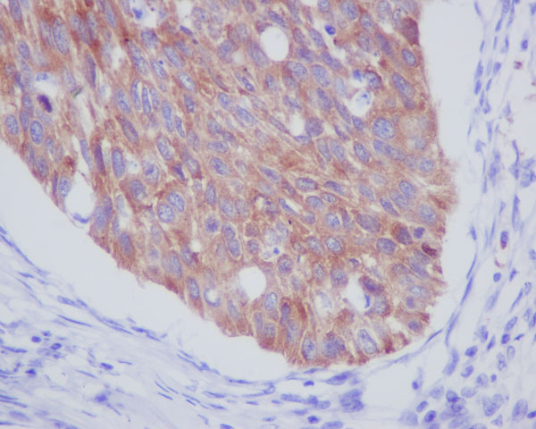 Immunohistochemistry (Formalin/PFA-fixed paraffin-embedded sections) - Anti-IMP3 antibody [EPR12021-114] (AB179807)