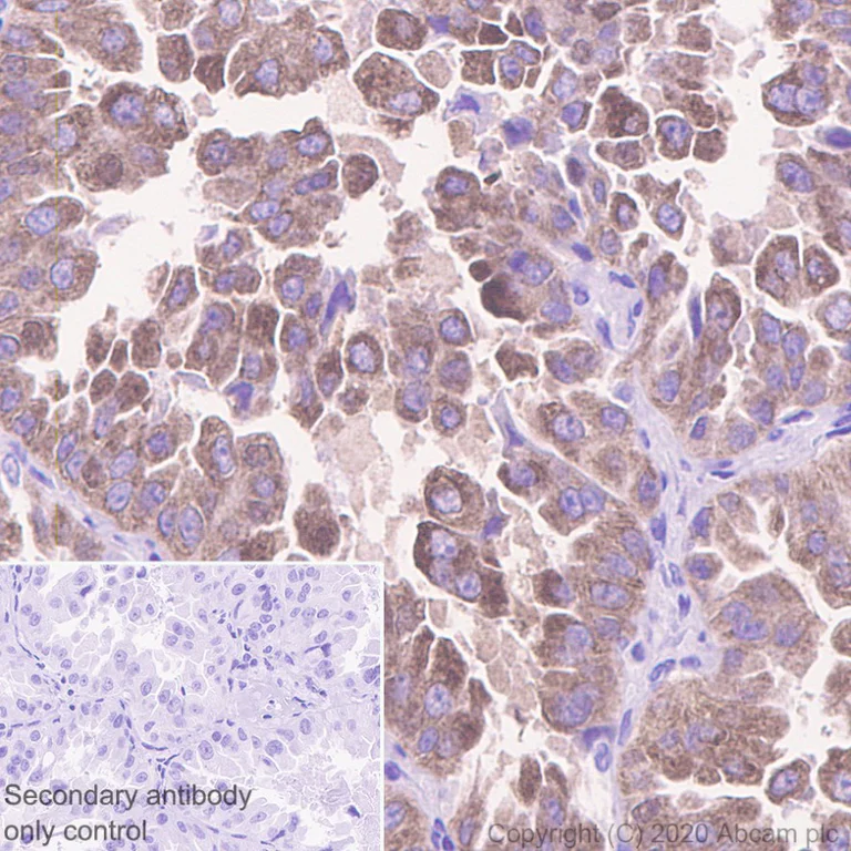 Immunohistochemistry (Formalin/PFA-fixed paraffin-embedded sections) - Anti-IMP3 antibody [EPR12021-114] - BSA and Azide free (AB250113)