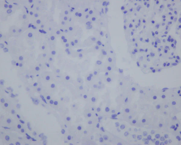 Immunohistochemistry (Formalin/PFA-fixed paraffin-embedded sections) - Anti-IMP3 antibody [EPR12021-114] - BSA and Azide free (AB250113)