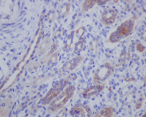 Immunohistochemistry (Formalin/PFA-fixed paraffin-embedded sections) - Anti-IMP3 antibody [EPR12021-114] - BSA and Azide free (AB250113)