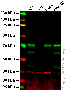 Western blot - Anti-IMP3 antibody [EPR12021] (AB177477), expandable thumbnail