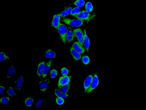 Immunocytochemistry/ Immunofluorescence - Anti-IMP3 antibody [EPR12022] (AB177942), expandable thumbnail