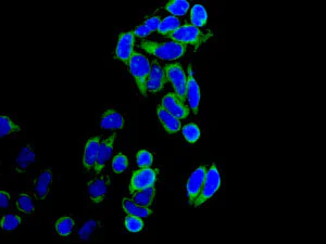 Immunocytochemistry/ Immunofluorescence - Anti-IMP3 antibody [EPR12022] (AB177942)