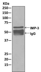 Immunoprecipitation - Anti-IMP3 antibody [EPR12022] (AB177942), expandable thumbnail