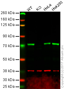 Western blot - Anti-IMP3 antibody [EPR12022] (AB177942), expandable thumbnail