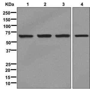 Western blot - Anti-IMP3 antibody [EPR12022] (AB177942), expandable thumbnail