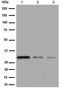 Western blot - Anti-IMPA1 antibody [EPR15405] (AB191570), expandable thumbnail