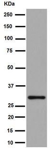 Western blot - Anti-IMPA1 antibody [EPR15405] (AB191570), expandable thumbnail