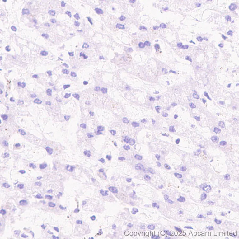 Immunohistochemistry (Formalin/PFA-fixed paraffin-embedded sections) - Anti-IMPDH1 antibody [EPR30383-519] (AB325431)