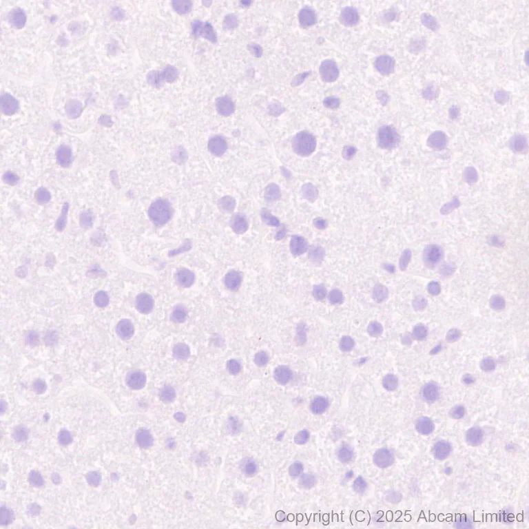 Immunohistochemistry (Formalin/PFA-fixed paraffin-embedded sections) - Anti-IMPDH1 antibody [EPR30383-519] - BSA and Azide free (AB325441)