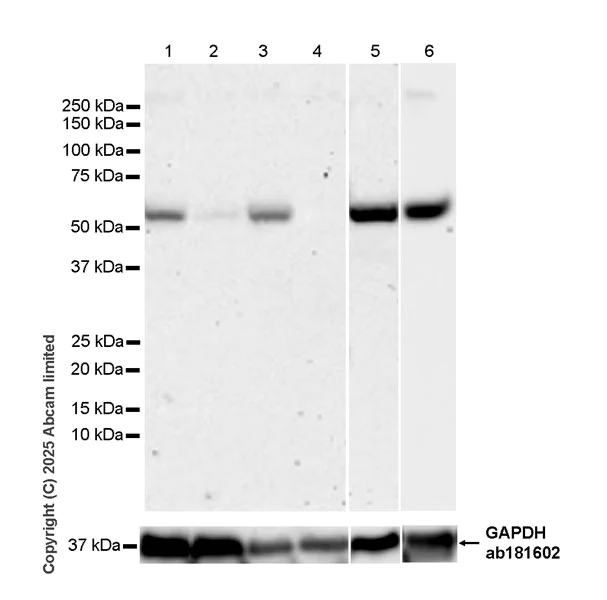 Western blot - Anti-IMPDH1 antibody [EPR30383-519] - BSA and Azide free (AB325441)