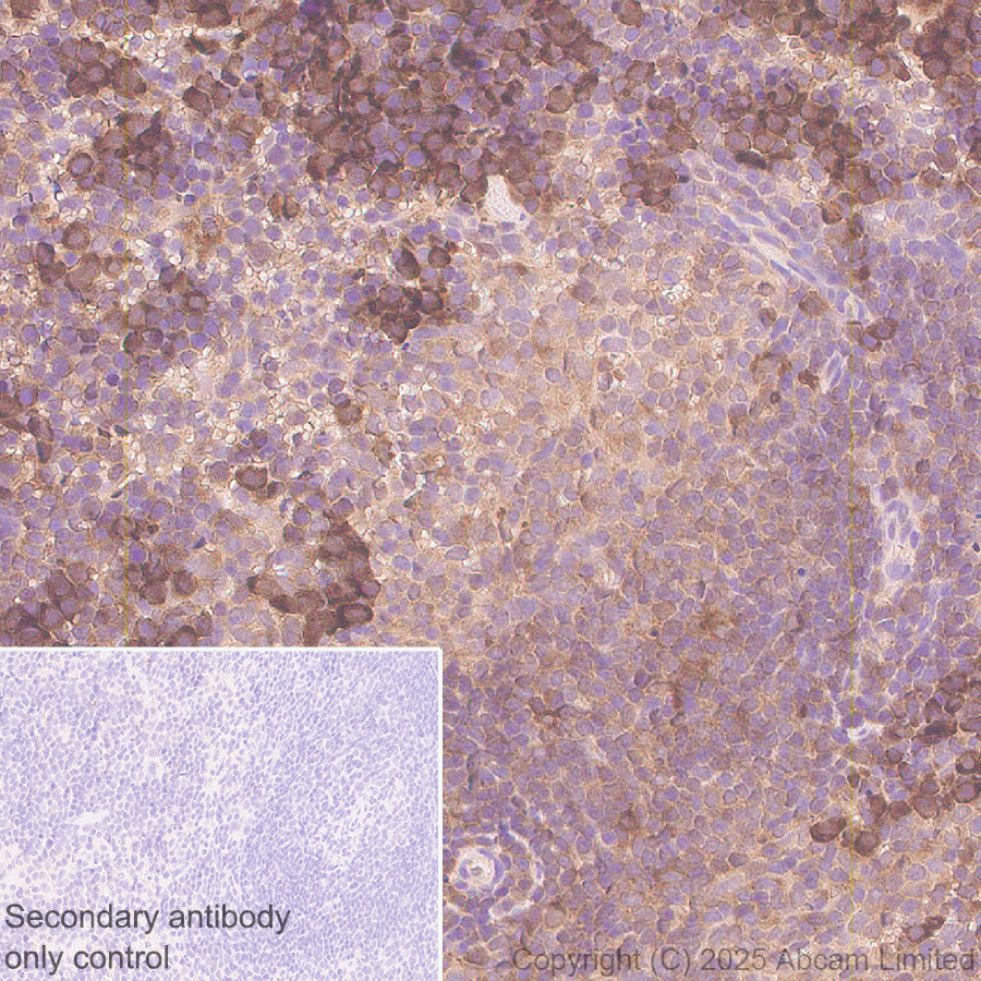 Immunohistochemistry (Formalin/PFA-fixed paraffin-embedded sections) - Anti-IMPDH2 antibody [EPR29835-594] (AB323871), expandable thumbnail