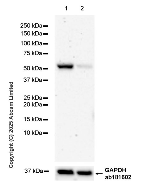 Western blot - Anti-IMPDH2 antibody [EPR29835-594] (AB323871), expandable thumbnail