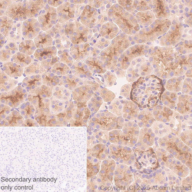 Immunohistochemistry (Formalin/PFA-fixed paraffin-embedded sections) - Anti-IMPDH2 antibody [EPR29835-594] - BSA and Azide free (AB323877)